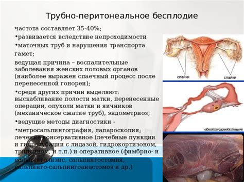 Перенесенные воспалительные заболевания