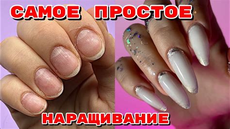 Периодическое подрезание ногтей