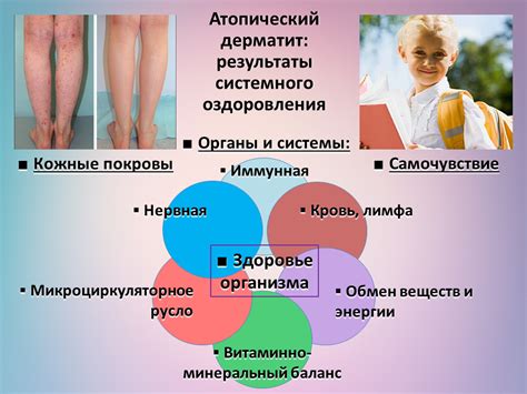 Перхоть и кожные заболевания