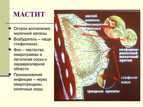 Пищеварительные причины, вызывающие непроизвольное пуканье