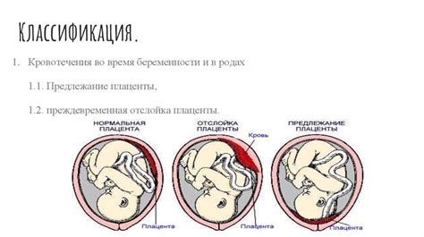 Плацента на ранних сроках беременности