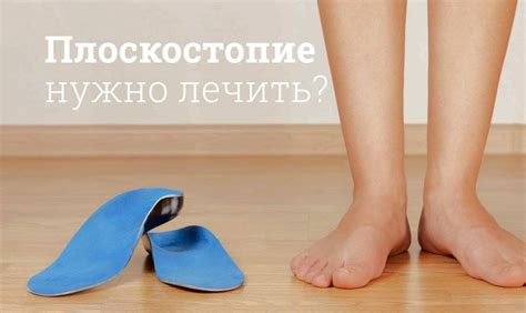 Плоскостопие и высокие пятки