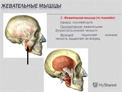 Плохая жевательная функция