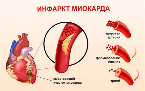 Плохая кровоснабжаемость