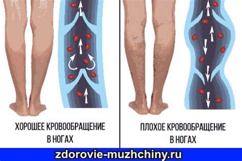 Плохое кровообращение в ногах