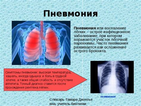 Пневмония и высокая температура: связь и объяснение