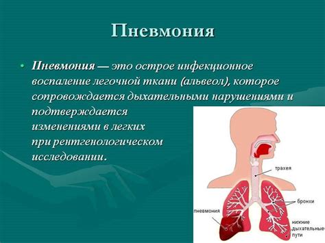 Пневмония и ее симптомы