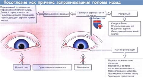 Поведенческие причины выгибания и запрокидывания головы