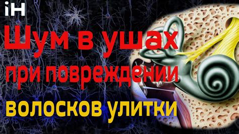 Повреждение внутреннего уха