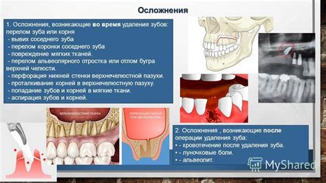 Повреждение челюсти или лица