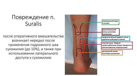 Повреждение шва и воспаление