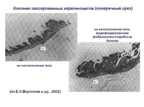 Повреждение эпидермиса