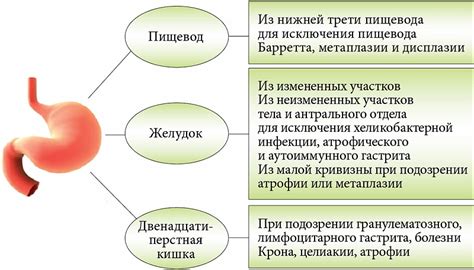 Повреждение эпителия желудка