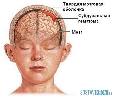 Повреждения мозга и их последствия