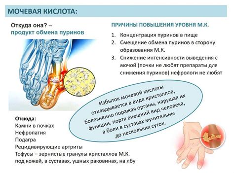 Повышена мочевая кислота у мужчин в крови: причины и лечение