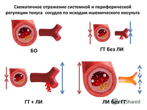 Повышение сосудистого тонуса для предотвращения кровотечения