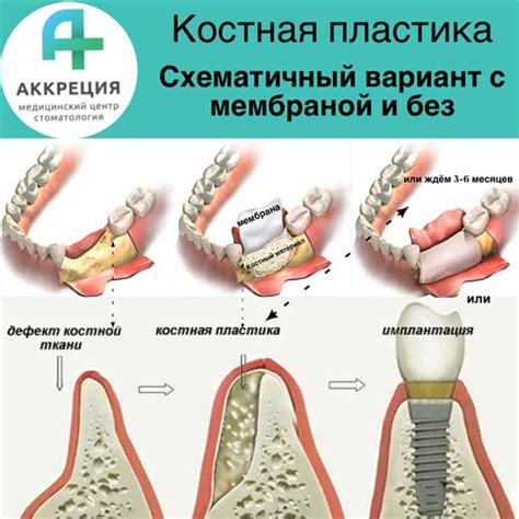 Повышение эстетического вида