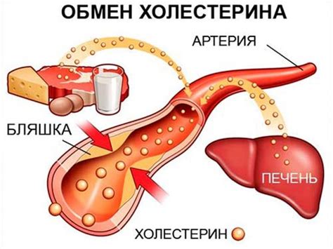 Повышенное содержание жира и холестерина