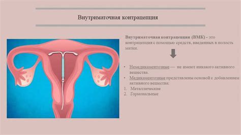 Подготовка перед установкой спирали