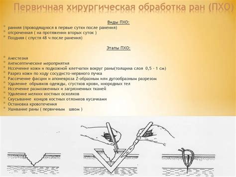 Подготовка раны и инструменты