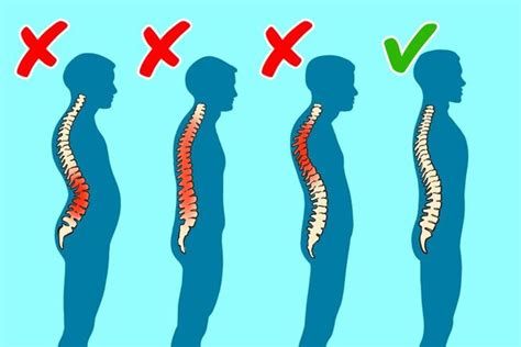 Поддерживайте правильную осанку