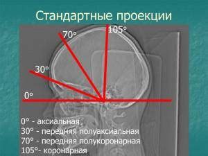 Под контролем: важные меры предосторожности при рентгенологических исследованиях