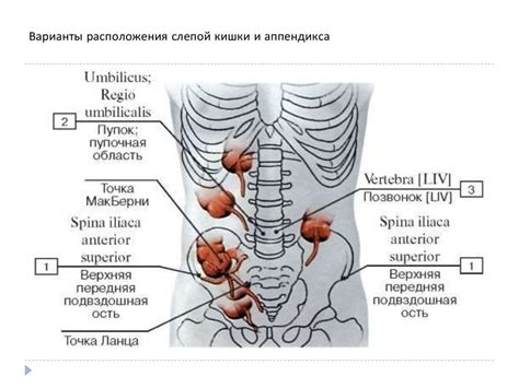 Поиск и изоляция аппендикса