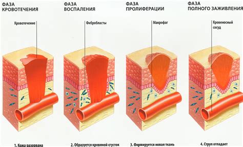 Покрытие раны после травмы для быстрого заживления