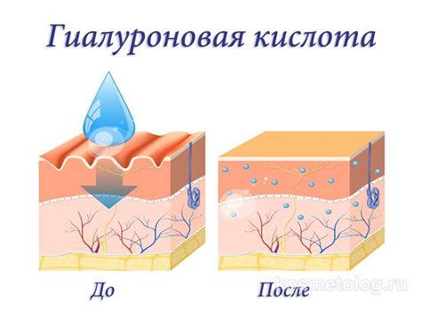 Полезные советы для быстрого удаления гиалуроновой кислоты дома