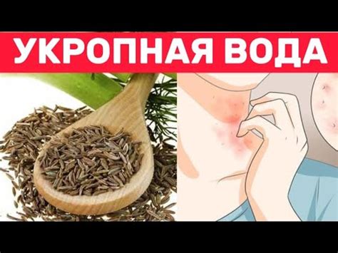 Полезные советы по использованию укропной воды