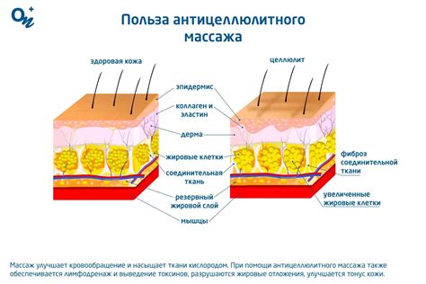 Польза антицеллюлитного массажа в борьбе с жиром на животе