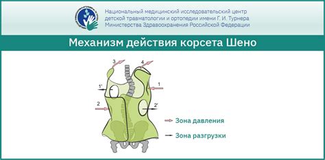 Польза корсета шено для спортивных тренировок