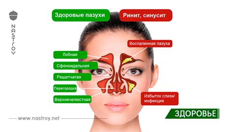 Помощь специалистов в борьбе с неприятным запахом в носу