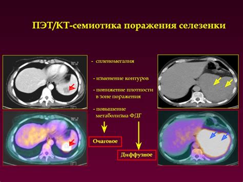 Понижение метаболизма