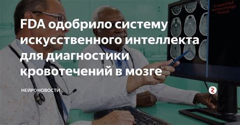 Понимание симптомов кровоизлияния в мозге для быстрой диагностики