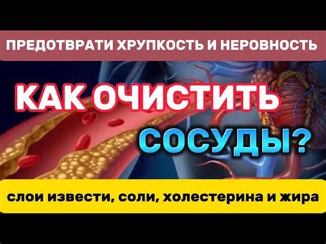 Популярные мифы о кальцинировании сосудов