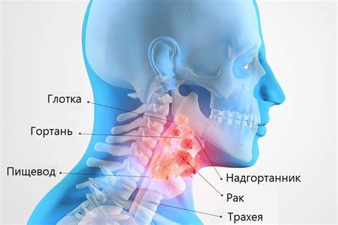 Поражение гортани: симптомы и лечение для взрослых и детей