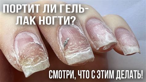 Портит ли гель-лак ногти?