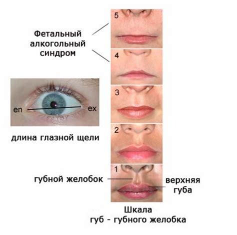 Последствия наличия хонора