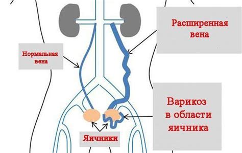 Последствия расширения таза