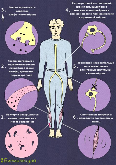 Последствия столбняка и как их предотвратить