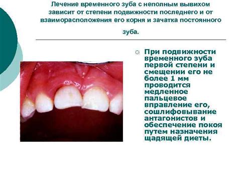 Потенциальные повреждения зубов