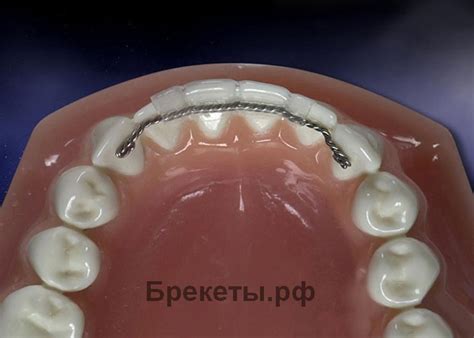 Потенциальные последствия налета на ретейнер