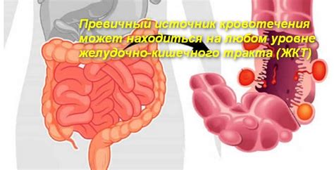 Потенциальные причины: кровотечение из кишечника