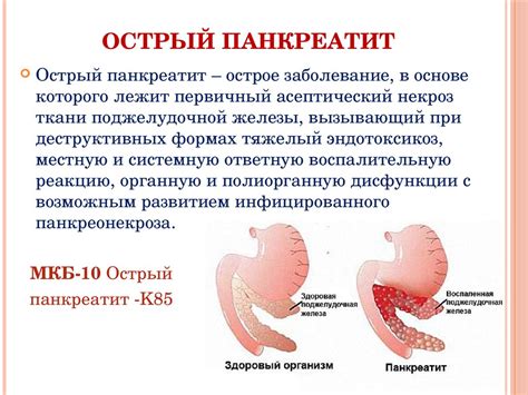 Потенциальные проблемы с панкреатитом