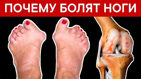 Почему возникает боль в пальцах на ногах и как ее снять