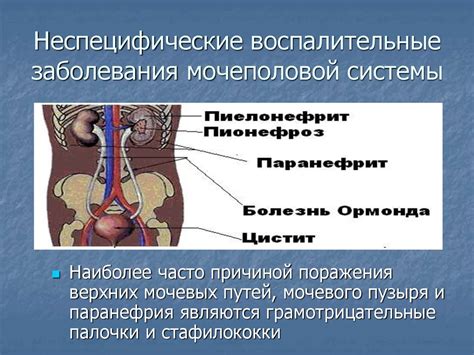 Почему возникает дискомфорт в органах мочеполовой системы