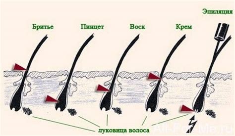 Почему не стоит брить волосы на ногах