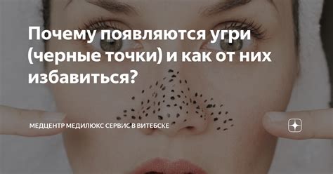 Почему появляются черные точки в ушах