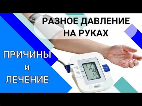 Почему руки имеют разное давление: причины и лечение